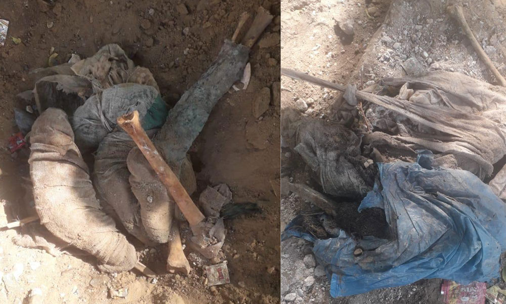 کراچی:-ناظم-آباد-سے-انسانی-ہڈیاں-برآمد