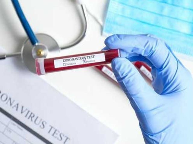 پاکستان-میں-کورونا-وائرس-کے-مریضوں-کی-تعداد-53-ہوگئی