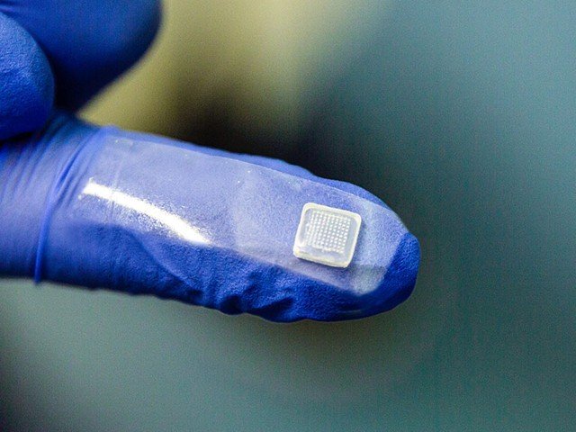 کھال-پر-چپک-کر-خون-میں-شکر-کم-ہونے-سے-روکنے-والا-ذہین-پیوند