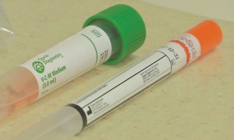 ٹسیٹنگ-کٹس-کے-’محتاط-استعمال‘-سے-وائرس-کی-تشخیص-میں-تاخیر