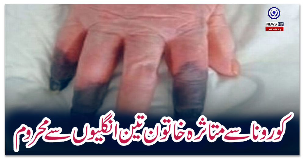 کورونا-سے-متاثرہ-خاتون-تین-انگلیوں-سے-محروم