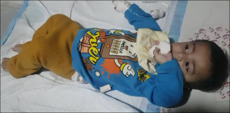 ڈاکٹر-کی-سنگین-غفلت،-6-ماہ-کے-بچے-کو-انگلی-سے-محروم-ہونا-پڑ-گیا