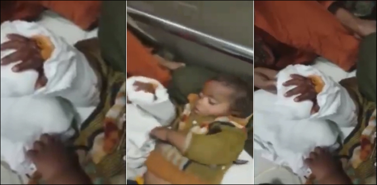 پاکستانی-ڈاکٹرز-کا-بڑا-کارنامہ،-بچے-کا-کٹا-ہاتھ-جوڑ-دیا