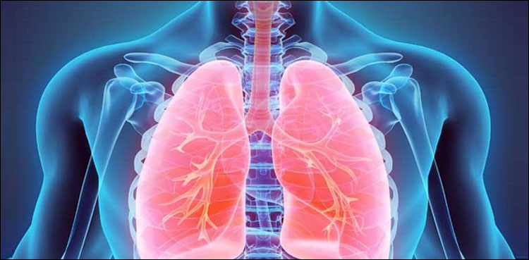 ٹی-بی-کا-عالمی-دن:-پاکستان-تپ-دق-کا-شکار-ممالک-میں-چھٹے-نمبر-پر