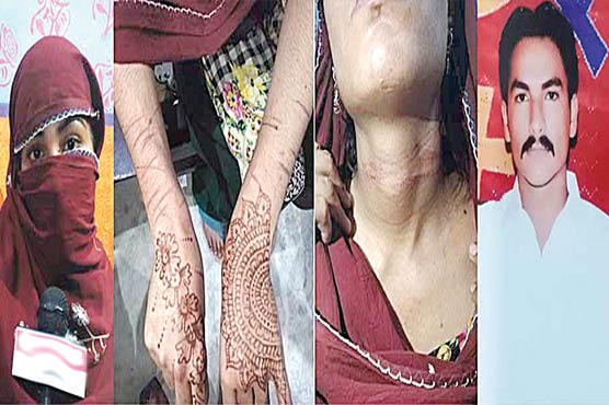 سسرالیوں-کا-بہو-پر-تشدد،گرم-چھریوں-سے-جسم-داغتے-رہے