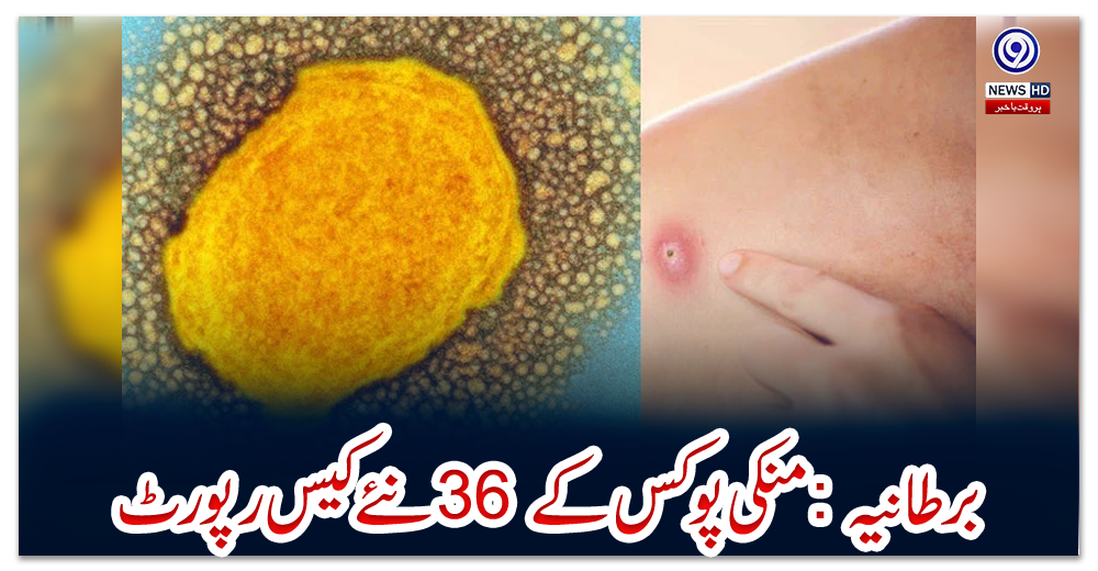 برطانیہ-:-منکی-پوکس-کے-36-نئے-کیس-رپورٹ